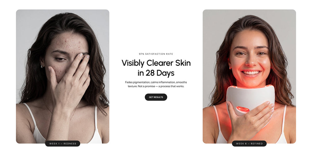 Validate results with B&A Section for Shopify | Omnise